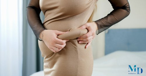 Belt Lipectomy Surgery: Comprehensive Body Contouring After Major Weight Loss